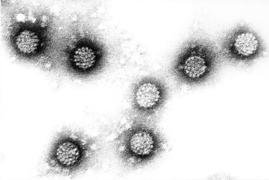 Human papillomavirus